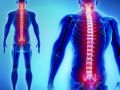 patologia degenerativa colonna vertebrale 1