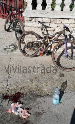 Alberobello Incidente ciclisti buca stradale