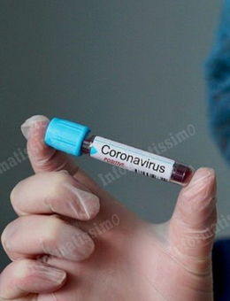 coronavirus tampone