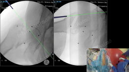 Ortopedia EBANAV 3D al Di Venere 2